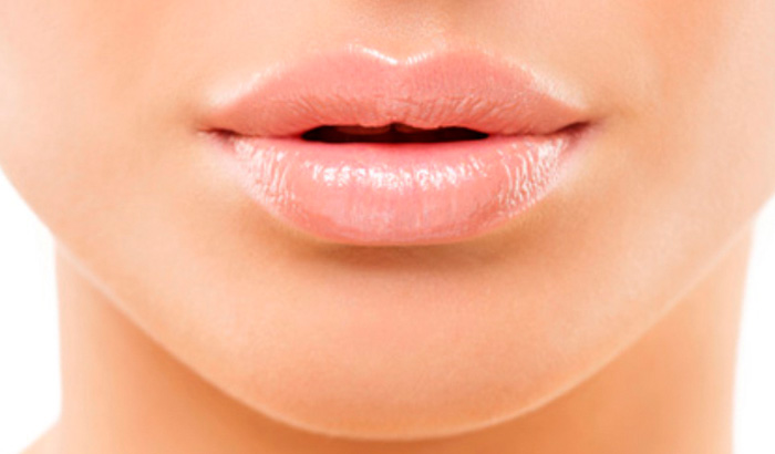 Lippenformung und Lippenvergrößerung mit Hyaluronsäure